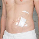 SEAL-TIGHT Shield Dressing , 8 L X 5 W Inch, 6 L X 3.5 W Inch Coverage Area, 20435 - Pack of 5